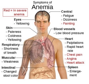 anemiasymptoms